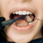 Is Dental Cleaning Safe? Common Myths About Dental Cleaning